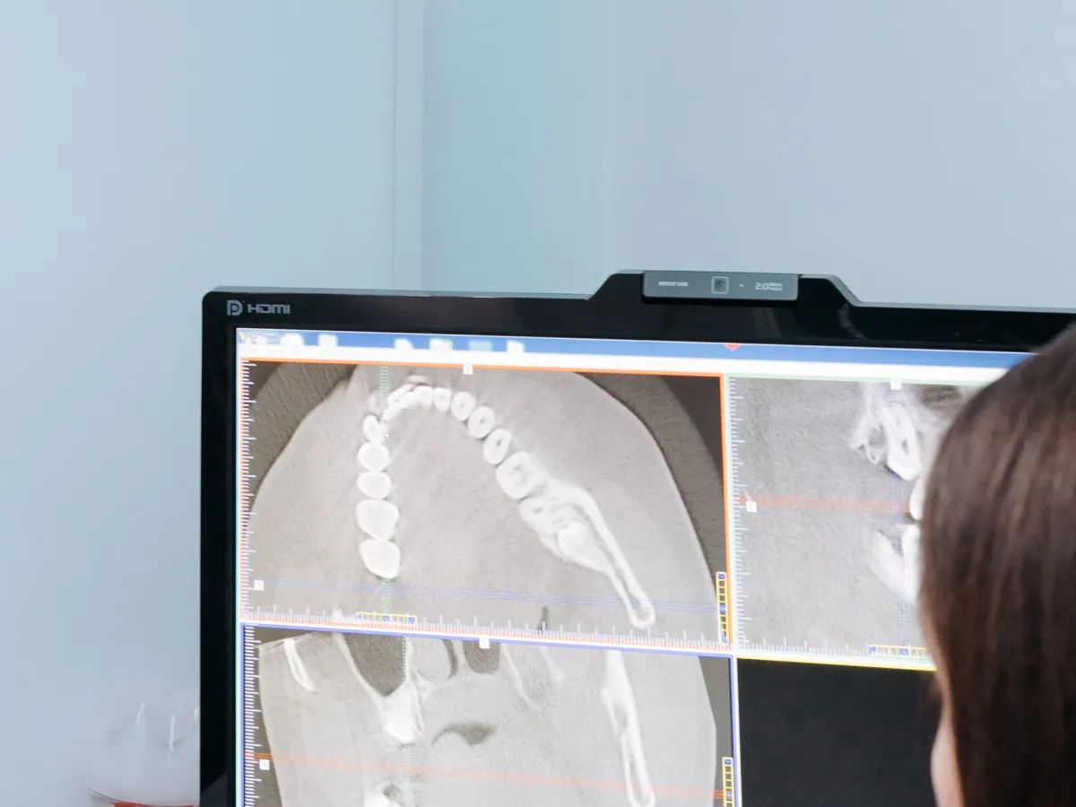 Reviewing a patient's 3D CBCT scan on screen — every restoration starts as a digital design