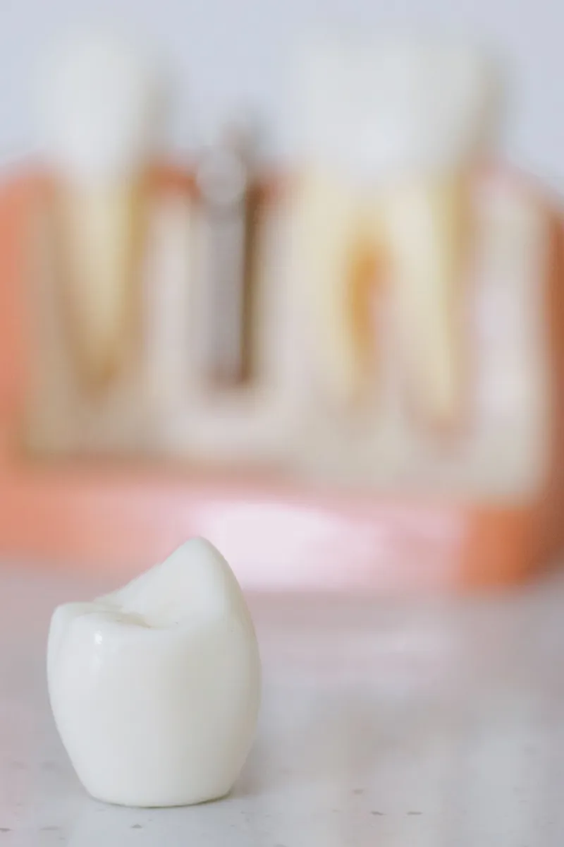 Dental crown with an implant model — planning the right restoration