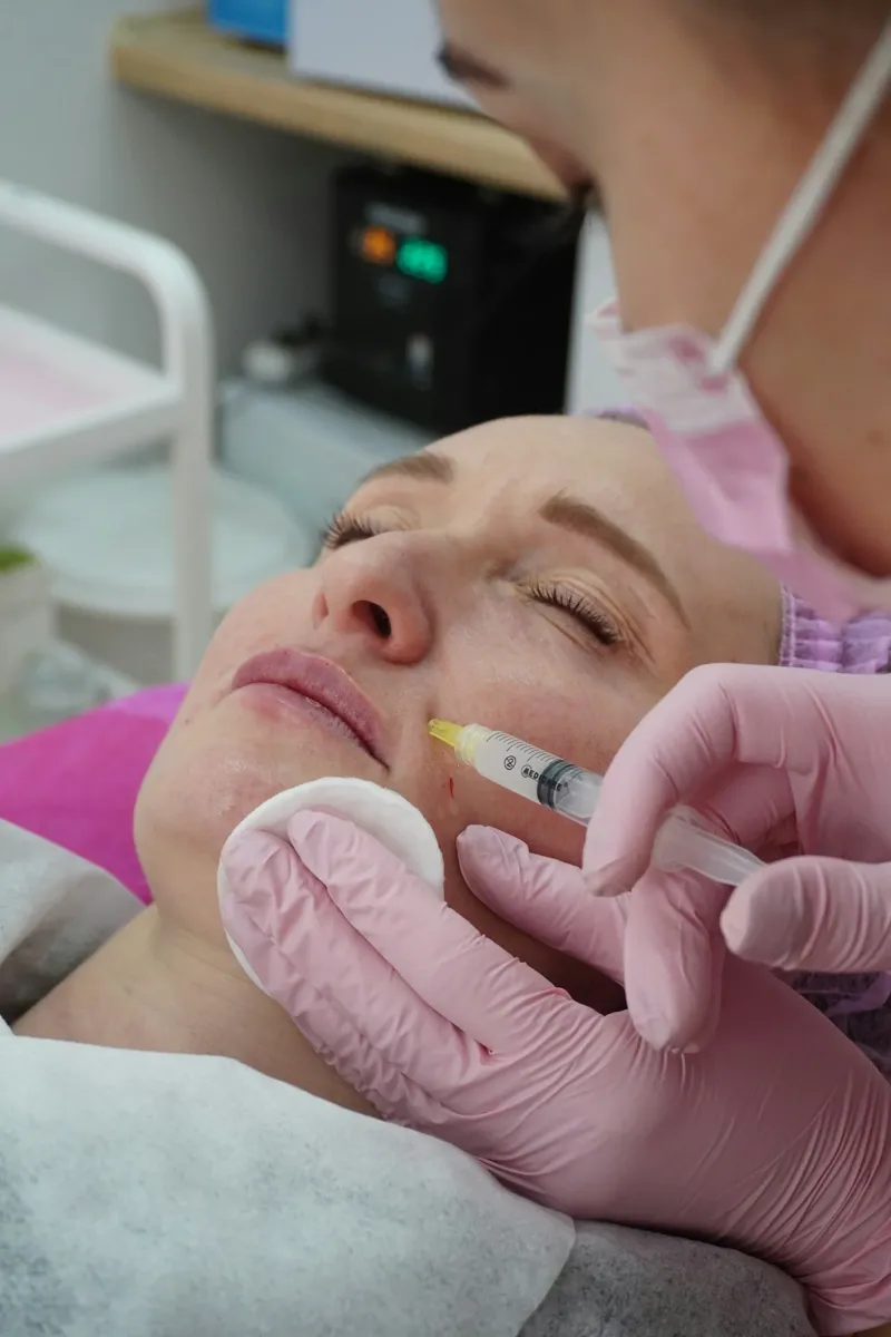 Practitioner performing a facial filler treatment