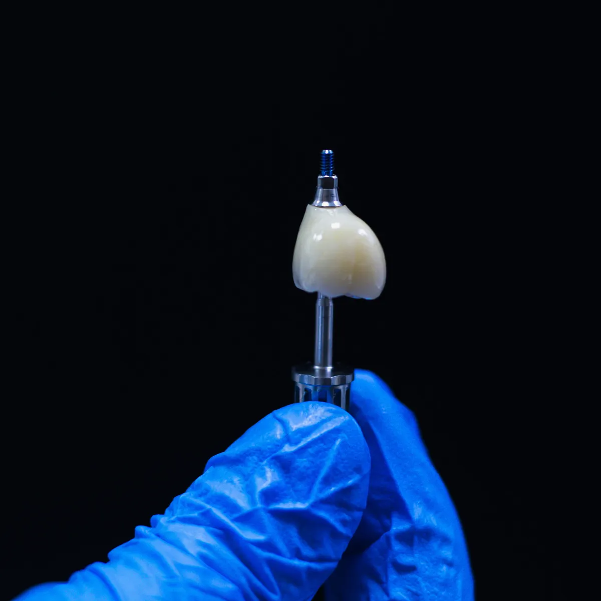 A single implant crown on its abutment, held in a gloved hand — the complete single-tooth replacement
